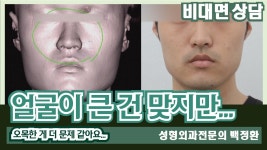 네이버 인플루언서 [네이버 인플루언서] (SUB) 얼굴이 큰 건 맞지만 오목한 게 더 문제 같아요... [비대면상담 334] / Its true that... 