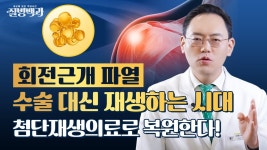 인플루언서] 회전근개파열 수술 후 재파열을 막는 방법, 요즘은 수술 대신 재생합니다! @제애정형외과 (#어깨명의 #회전근개파열 #회전근개파열수술)