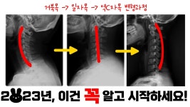 네이버 인플루언서 [네이버 인플루언서] 만병의 근원 제대로 이해하기 (어깨통증,무릎통증,골반통증,거북목 등)