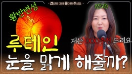 성모하늘빛안과내눈건강식품 | 네이버 인플루언서 [네이버 인플루언서] 👁️안구를 깨끗하게 해주는 영양제가 루테인이라고?? | 안과의사가 추천하는 영양제?!- [건물주 Ep.45]