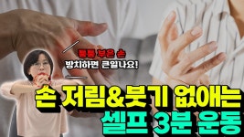 네이버 인플루언서 [네이버 인플루언서] 못생기고 퉁퉁 부은 손, 더 이상 감추지 마세요! 손 붓기 완벽하게 빼는 운동
