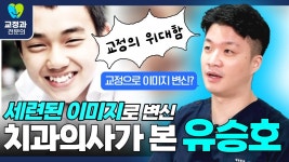네이버 인플루언서 [네이버 인플루언서] 소년에서 남자가 된 배우 유승호! 덧니 교정으로 이렇게 변할 수 있다?! | 웃자치과 김종희 원장