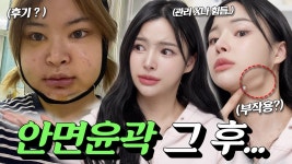 이 뷰튜버 언냐 보니까 윤곽갤플 생각나노 - 남자 연예인 갤러리