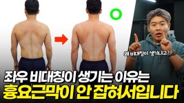 네이버 인플루언서 [네이버 인플루언서] 가짜 가동범위가 몸을 망친다