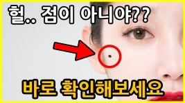 점인 줄 알았는데 훨씬 위험한 이것의 정체!!｜빨간토마토 | Doovi 점인 줄 알았는데 훨씬 위험한 이것의 정체!!｜빨간토마토