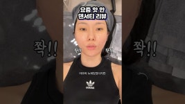 네이버 인플루언서 [네이버 인플루언서] 신상 리프팅 시술, 덴서티 리뷰 2