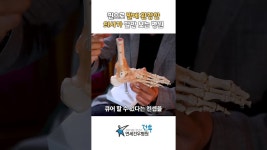 네이버 인플루언서 [네이버 인플루언서] 찐으로 발에 환장한 의사가 발만보는 병원 #무지외반증 #족저근막염 #연세건우병원 #박의현원장