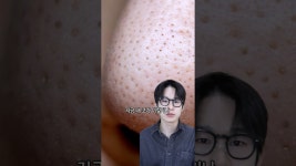 네이버 인플루언서 [네이버 인플루언서] 코에 까만 블랙헤드 깔끔하게 관리하는 법