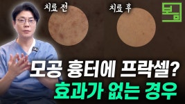 네이버 인플루언서 [네이버 인플루언서] 닥터봄의원 피부과의 패인흉터
