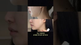 네이버 인플루언서 [네이버 인플루언서] 이중턱 없애주는 ㅇ모드 디바이스?ㅣ아랑 #세라매스