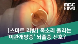[의학] 이관개방증 - 부동산 갤러리