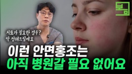 네이버 인플루언서 [네이버 인플루언서] 닥터봄의원 피부과의 안면홍조치료법