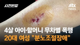 딱봐도 페미 - 치킨 갤러리