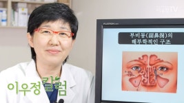 유명 한의사가 말하는 자가 비중격만곡증 치유법 - 비염 마이너 갤러리