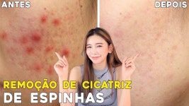 박소연스킨케어백옥생화장품 | 네이버 인플루언서 [네이버 인플루언서] 한국여자 소연뷰티의 스킨케어