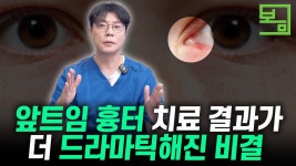네이버 인플루언서 [네이버 인플루언서] 닥터봄의원 피부과의 수술흉터