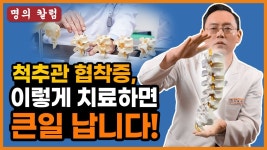 네이버 인플루언서 [네이버 인플루언서] 척추관 협착증, 이렇게 치료하면 큰일 납니다 @제애정형외과 서희수 대표원장 (#척추관협착증 #척추협착증... 