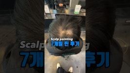 네이버 인플루언서 [네이버 인플루언서] 두피페인팅 유지력 공개 #두피염색 #두피페인팅 #두피커버링 #두피메이크업 #정수리탈모 #두피문신... 