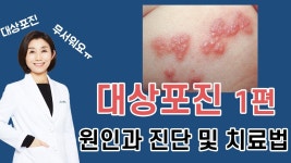 네이버 인플루언서 [네이버 인플루언서] 하나이비인후과병원의 대상포진증상