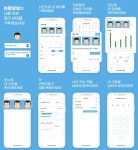 탈모 걱정이신 분들 진행중인 분들을 위한 앱 위풍당당 나의 머리 사진기록