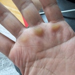 쇠질하면 손에 굳은살 생기는게 당연하지만