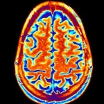 Stream Brainmap by 이낙원 | Listen online for free on SoundCloud Brainmap