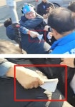 서울 이송 왜 자작극 이재명 피습 논란에 심혈관 명의 일침