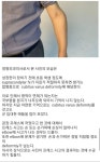 정형외과 의사가 본 잼명이 팔
