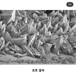 요로결석이 아픈이유