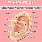 귀 피어싱 부위별 고통수준