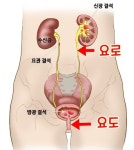 베스트 요로결석 만화보고 하나 짚고 넘어가는거