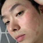 운동하면서 얼굴 실핏줄 다 터짐