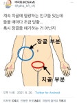 여러분 치골과 장골은 다릅니다jpg
