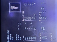 요거 두방패는 전투기술없음 못다나요? | 엘든 링 요거 두방패는 전투기술없음 못다나요? | 엘든 링 | 루리웹