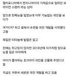 암으로 한쪽 눈을 잃은 남자의 의안