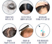 다모 초기탈모 3스텝 두피 힐링키트 - 예스24