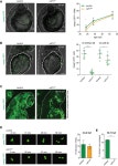 Csf1r-independent metaphocytes | eLife Zebrafish macrophage... depletion of microglia and reveals Csf1r-independent metaphocytes