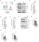 Loss of MGA repression mediated by an atypical polycomb complex promotes tumor progression and invasiveness | eLife Loss of MGA... 