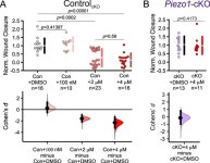 Figures and data in Spatiotemporal dynamics of PIEZO1 localization controls keratinocyte migration during wound healing | eLife... 