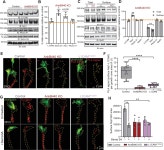 Figures and data in Giant ankyrin-B mediates transduction of axon guidance and collateral branch pruning factor sema 3A | eLife... 