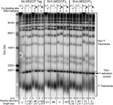 The Ku subunit of telomerase binds Sir4 to recruit telomerase to lengthen telomeres in S. cerevisiae | eLife The Ku subunit of... 