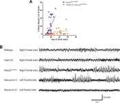 Figures and data in Restoration of Mecp2 expression in GABAergic neurons is sufficient to rescue multiple disease features in a... 