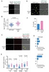 Polo-like kinase Cdc5 regulates Spc72 recruitment to spindle... Spc72 recruitment to spindle pole body in the methylotrophic... 