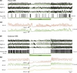 Motoneurons regulate the central pattern generator during drug-induced locomotor-like activity in the neonatal mouse | eLife... 