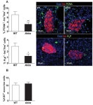 Figures and data in Inhibition of mTORC1 by ER stress impairs neonatal β-cell expansion and predisposes to diabetes in the Akita... 