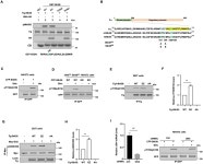 Ulk4 promotes Shh signaling by regulating Stk36 ciliary... by regulating Stk36 ciliary localization and Gli2 phosphorylation