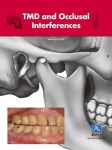 TMD and Occlusal Interferences | 이수빈 | 알라딘 TMD and Occlusal Interferences | 이수빈