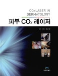알라딘: 피부 CO2 레이저 피부 CO2 레이저
