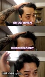 포모스 탈모가 점점 심해지는 로이 탈모가 점점 심해지는 로이
