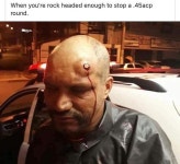 던전앤파이터 No.1 커뮤니티, 던전앤파이터 게임조선! - [유머] [혐주의] 머리에 총맞고 산 사람 [유머] [혐주의] 머리에 총맞고 산 사람